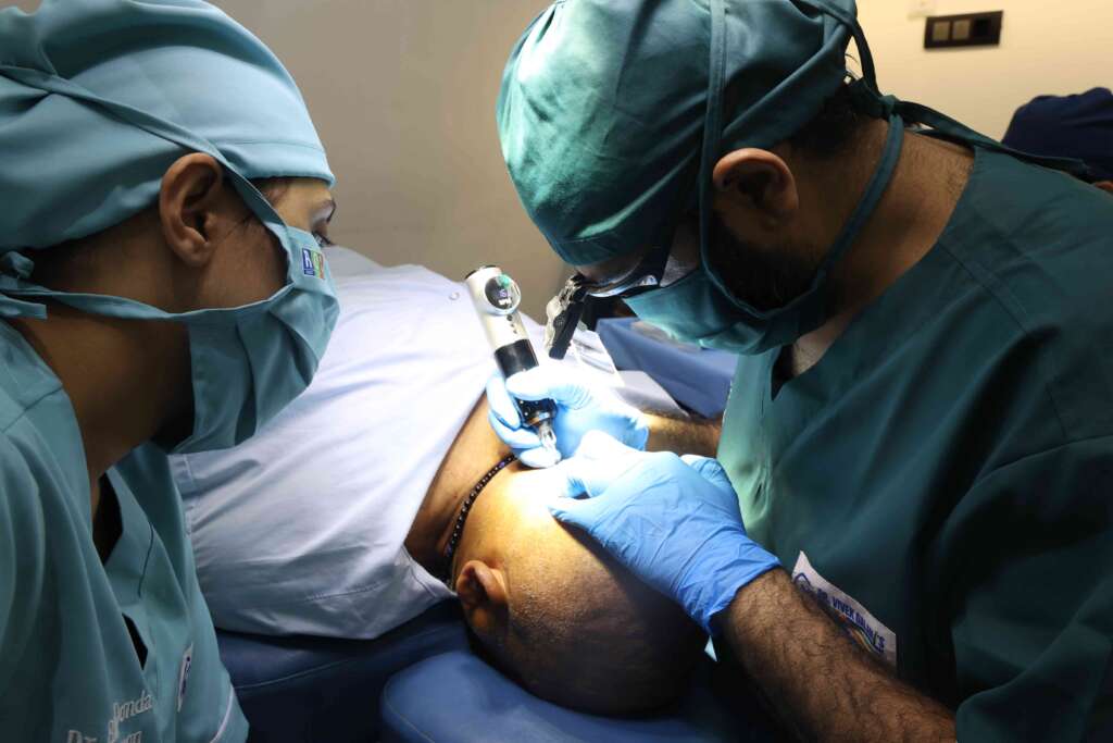 scalp micro pigmentation iuq6u5rswg