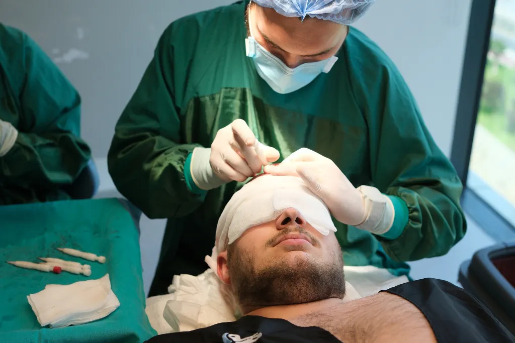 elithair medical team performing hair transplant on patients (1)